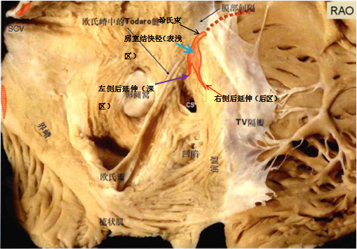 阵发性心房扑动吃什么药_阵发心房扑动_阵发性室上性心动过扑