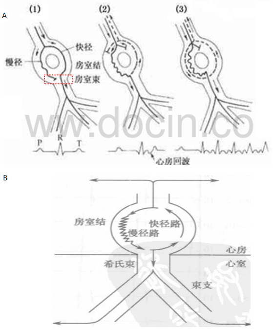 阵发性心房扑动吃什么药_阵发心房扑动_阵发性室上性心动过扑